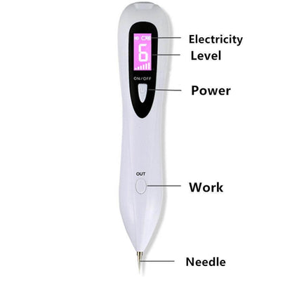 Cautery Pen Mole Removal