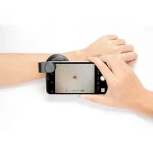 dermatoscope de 400